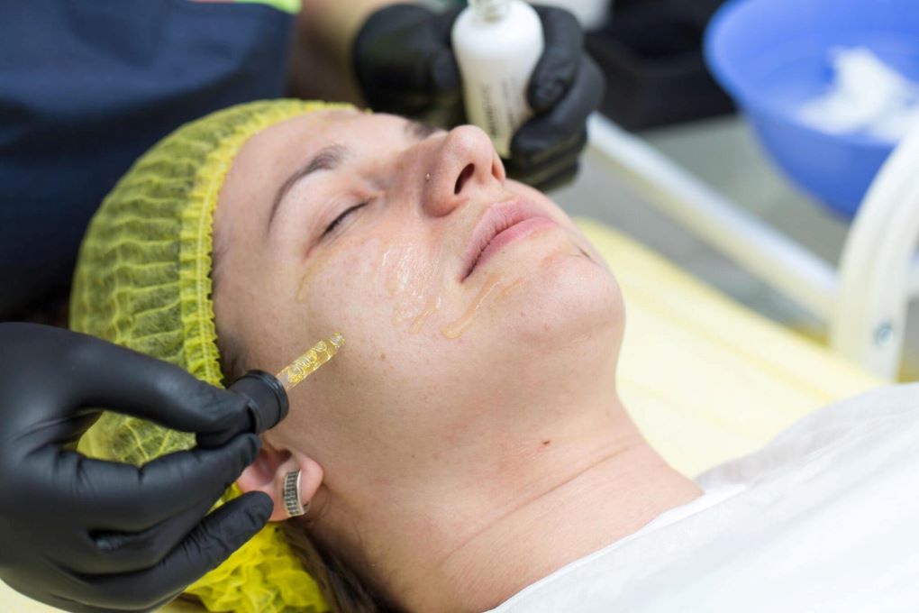 Unlocking Confidence: How Pigmentation Treatments Enhance Skincare Routines